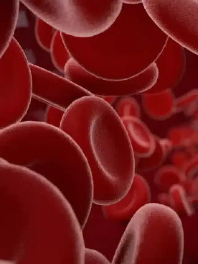 4 alimentos que combatem a anemia