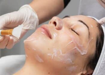 Peeling de fenol (Foto: Freepik)