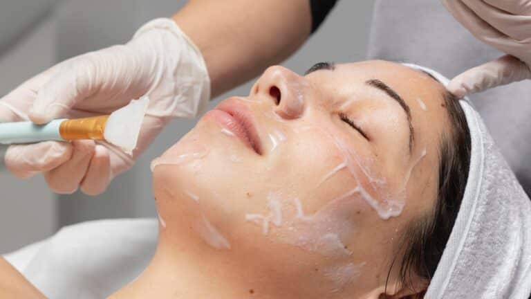 Peeling de fenol (Foto: Freepik)