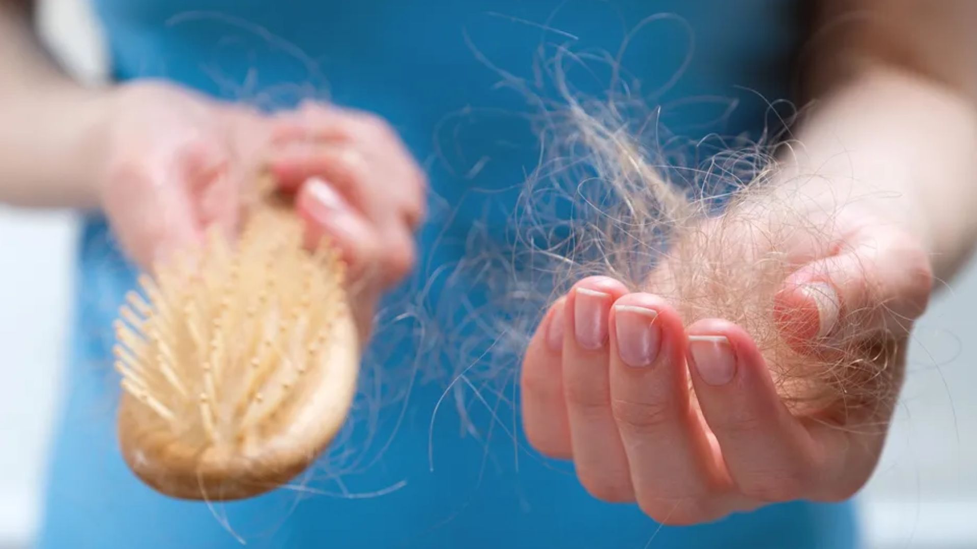 Queda de cabelo (Foto: Instagram)