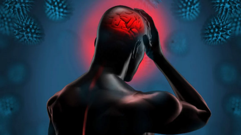 Enxaqueca (Foto: Freepik)