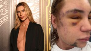 Junior Dutra antes e depois (Foto: Feed TV)