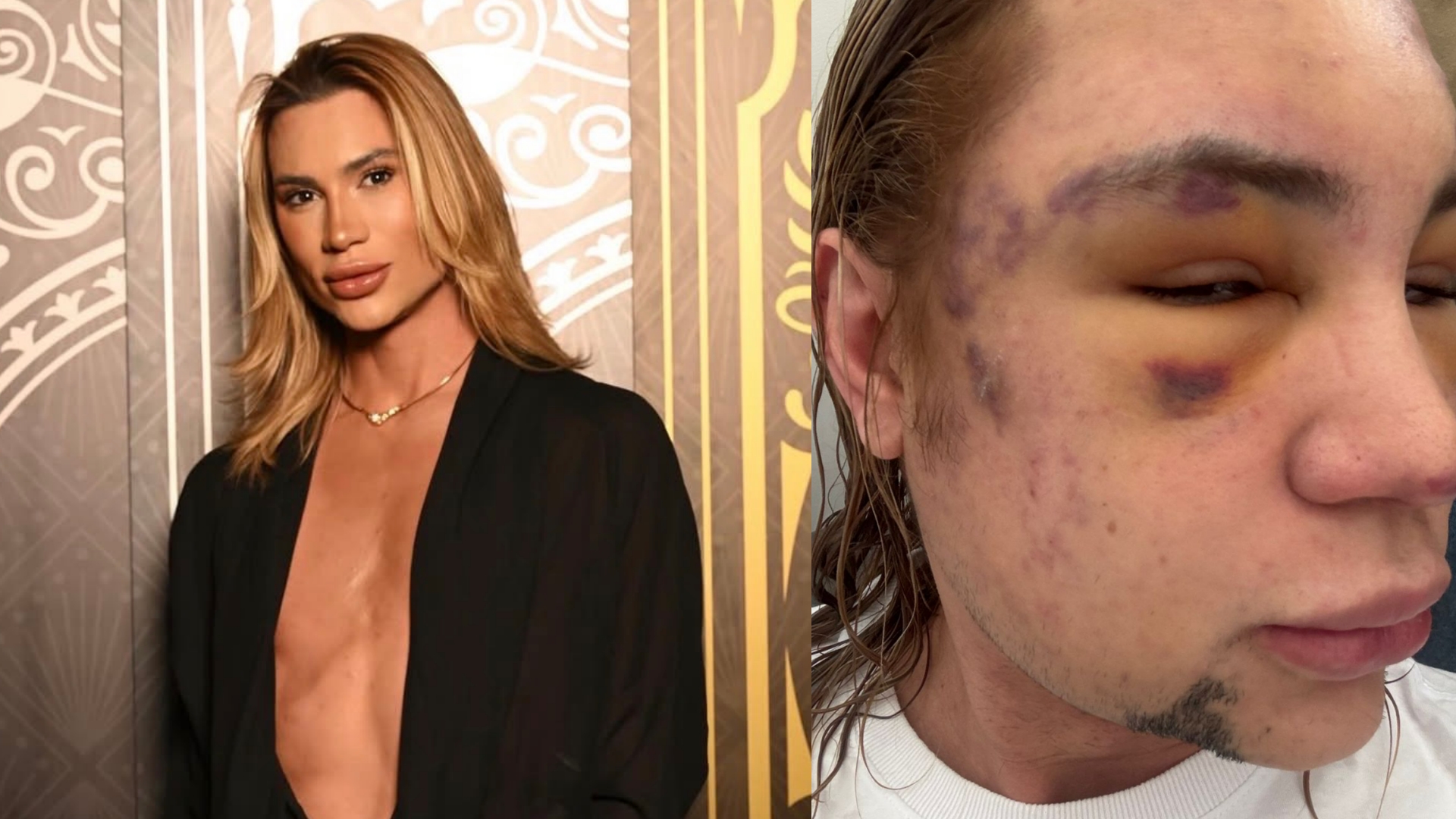 Junior Dutra antes e depois (Foto: Feed TV)
