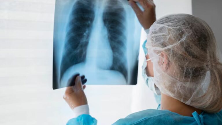 Câncer de pulmão (Foto: Freepik)