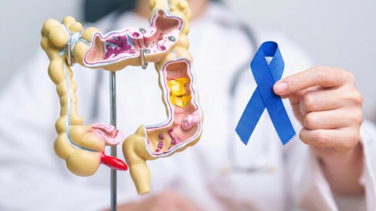 Cuidados com tumor colorretal (Foto: AI)