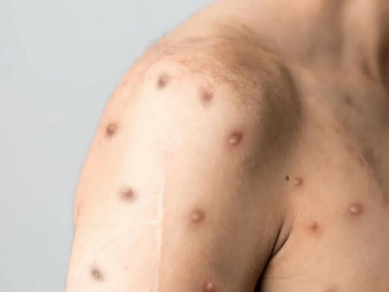 Créditos: Foto/Divulgação