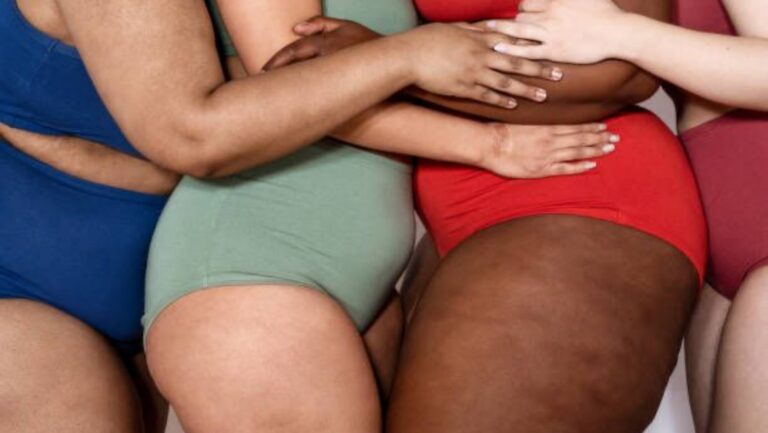 Celulite hormonal (Foto: Freepik)