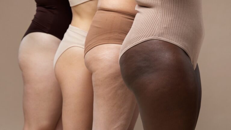 Celulite (Foto: Freepik)