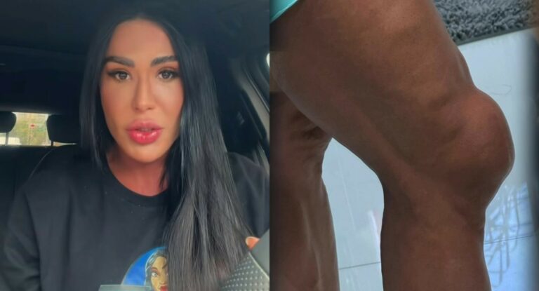 Gracyanne Barbosa e joelho (Foto: Instagram)